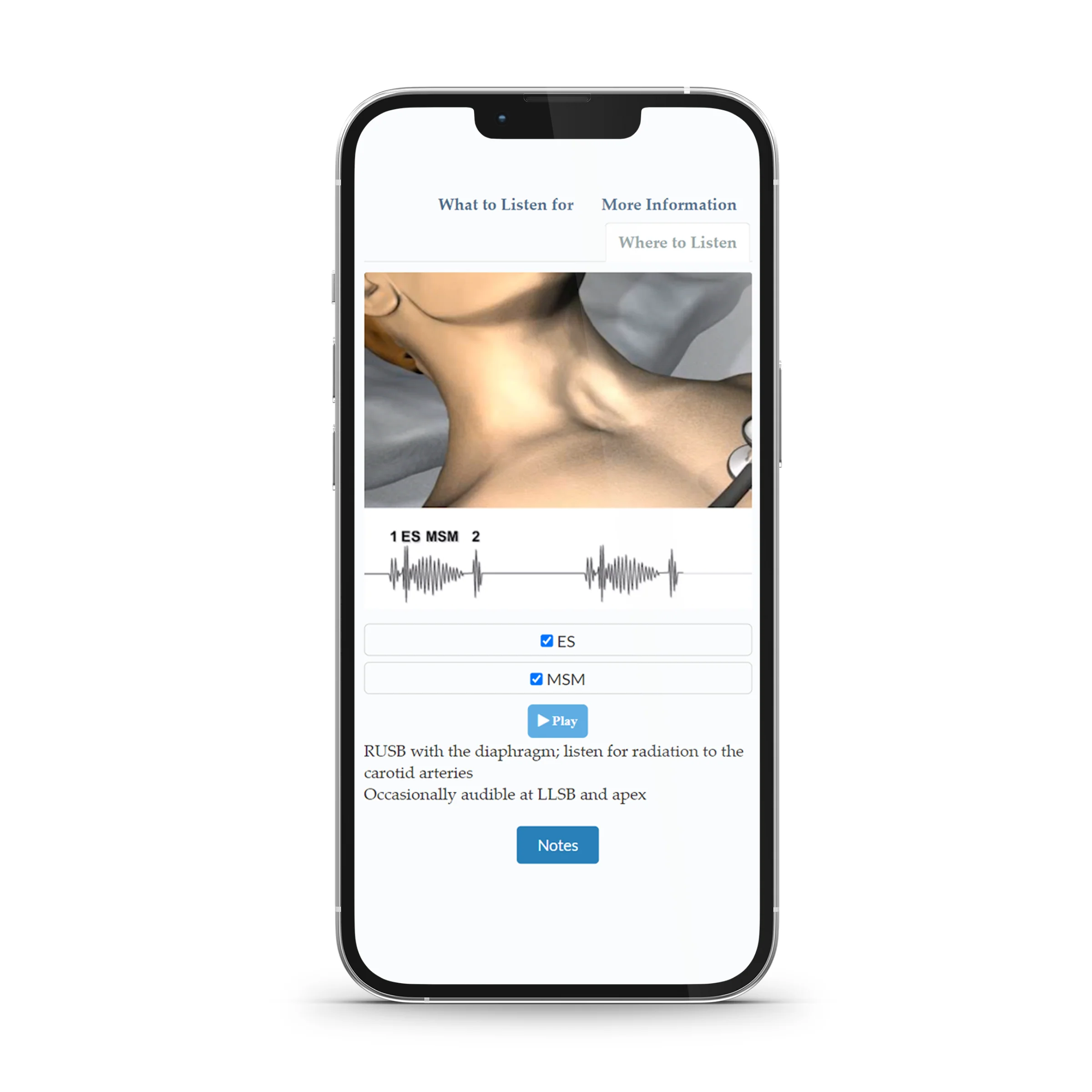 Heart Sounds - Image 3